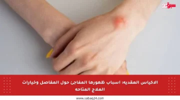 الأكياس العقدية: أسباب ظهورها المفاجئ حول المفاصل وخيارات العلاج المتاحة